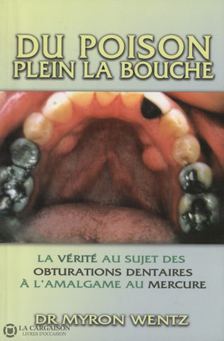 Wentz Myron. Du Poison Plein La Bouche:  La Vérité Au Sujet Des Obturations Dentaires À Lamalgame